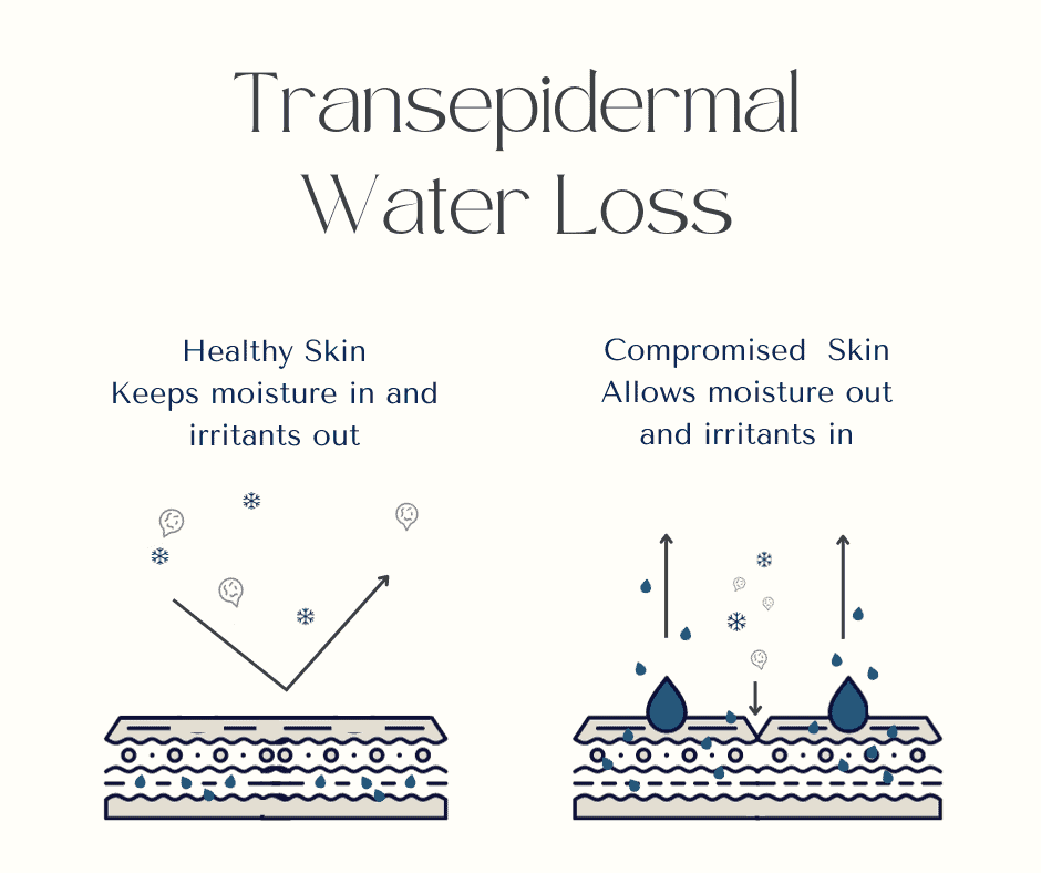 Transepidermal water loss blog photo 2 Wonder Balm from Vemel