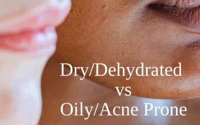 Dry/Dehydrated vs Oily/Acne Prone – How To Spot The Subtle Differences (and what to do next!)