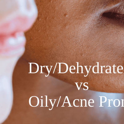 Dry/Dehydrated vs Oily/Acne Prone – How To Spot The Subtle Differences (and what to do next!)