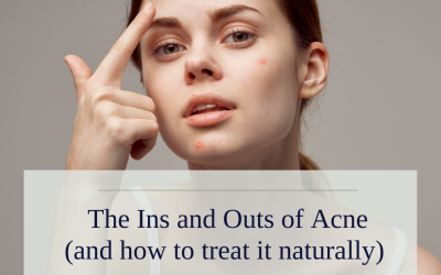 The Ins and Outs of Acne (and how to treat it naturally!)