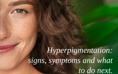 Hyperpigmentation: Signs, Symptoms and What To Do Next