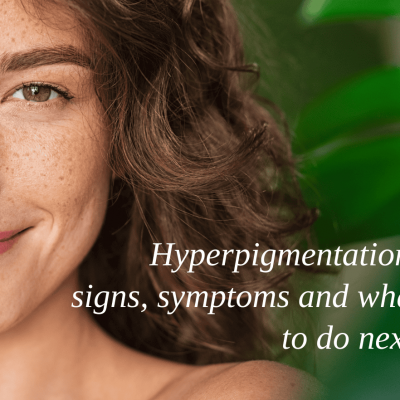 Hyperpigmentation: Signs, Symptoms and What To Do Next