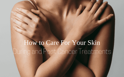 How to Care For Your Skin During and Post Cancer Treatments