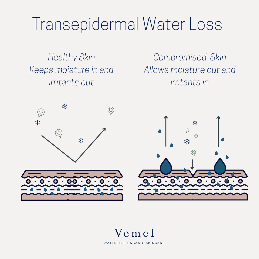 Transepidermal Water Loss What It Is and How to Stop It Vemel