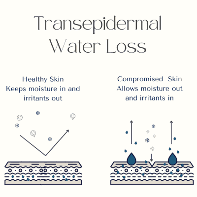 TRANSEPIDERMAL WATER LOSS – WHAT IT IS AND HOW TO STOP IT